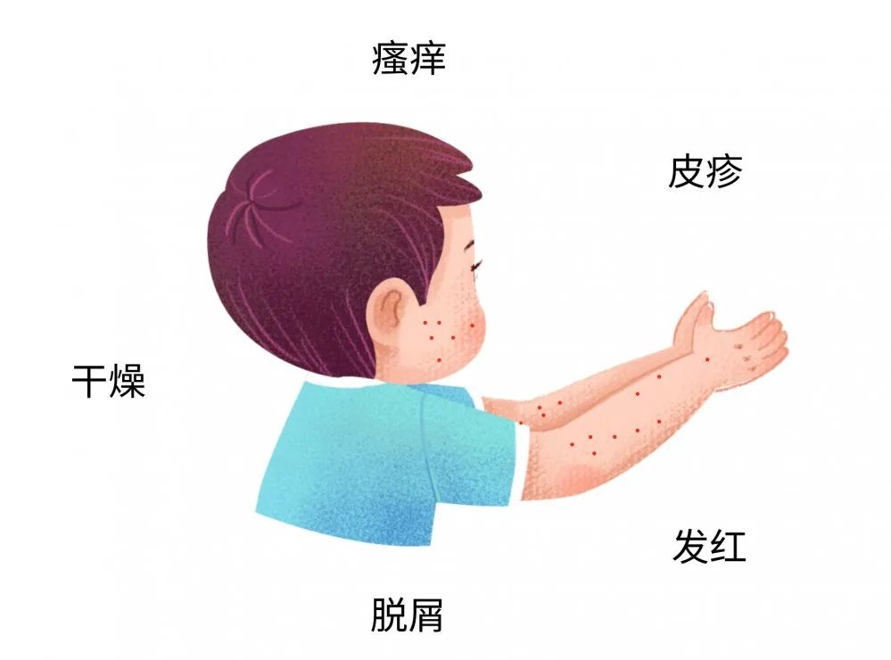 这些症状都可能是宝宝过敏传递的信号，，，，很多宝妈还不知道